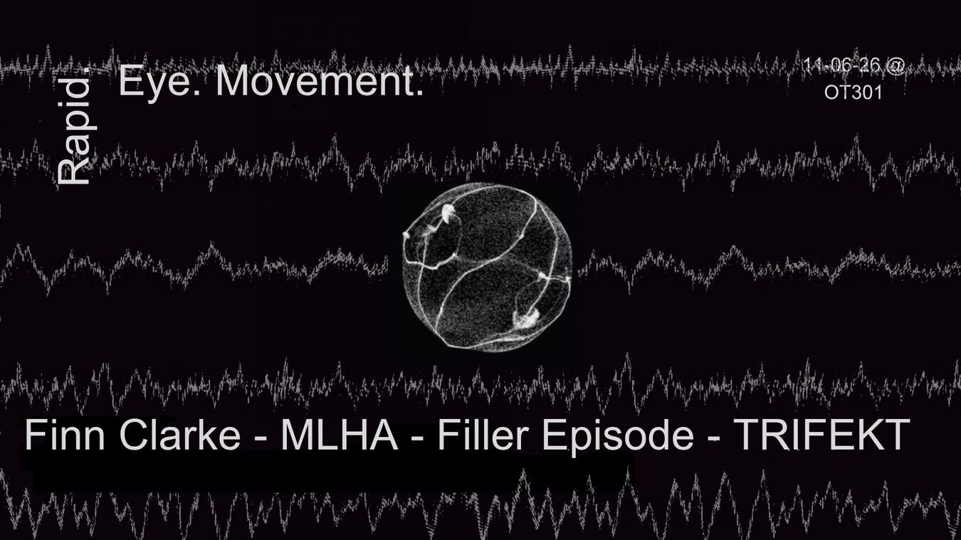 RAPID EYE MOVEMENT (R.E.M.) + TRIFEKT, MLHA, FINN CLARKE, FILLER EPISODE